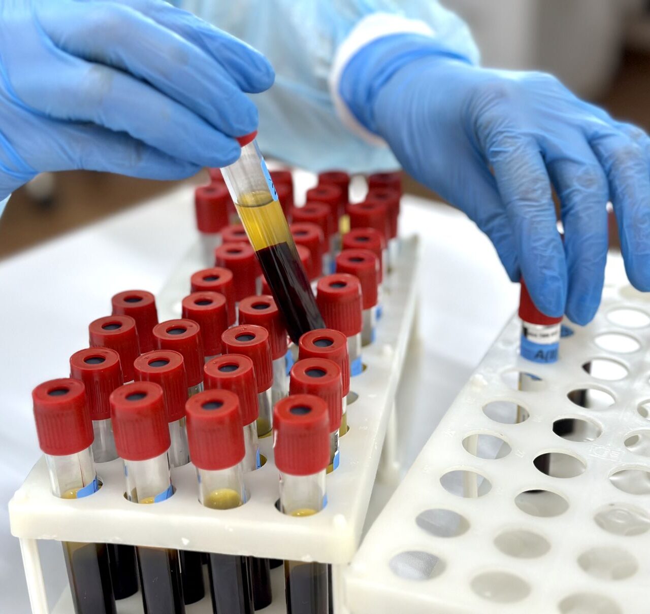 laboratory technician holding a blood tube test Laboratory assistant putting test tubes into the holder, Close-up view focused on the tubes